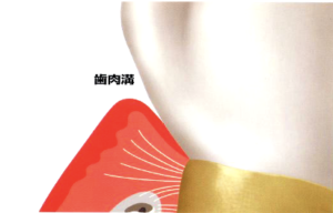 健康な歯肉