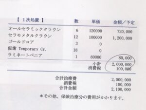 左上のインプラント希望５０歳女性