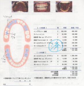 右上にものが詰まる