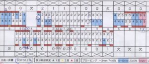 ゴールドの金属床の入れ歯