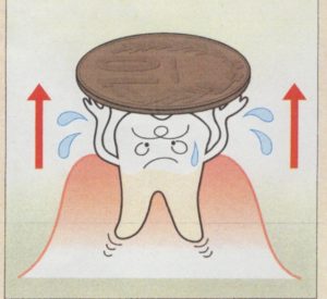 歯の萌出力