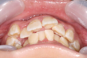 Beaver, protruding upper jaw