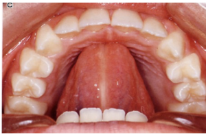 スポットポジション