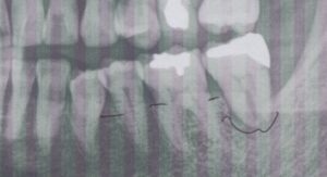 ブルーラジカルをしたい50代女性