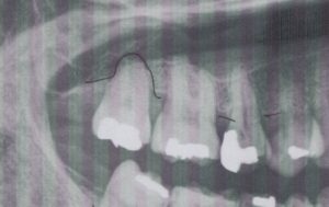 ブルーラジカルをしたい50代女性