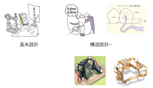 構造設計の入れ歯