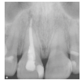 図３ 初診時のエックス線写真
