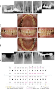 初診時(2003年12月)
