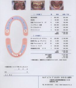 ひどい受け口ですが治せますか?