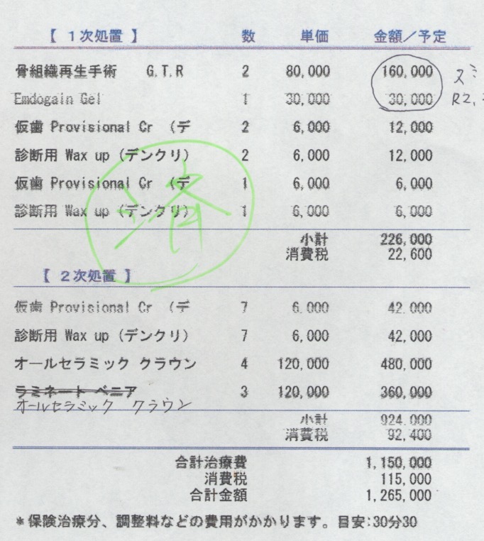歯肉のラインを揃えたい
