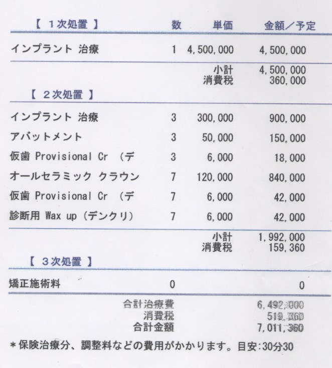 入れ歯からインプラントにしたい５０代女性