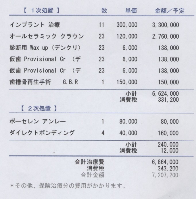 入れ歯をインプラントにしたい４０代男性