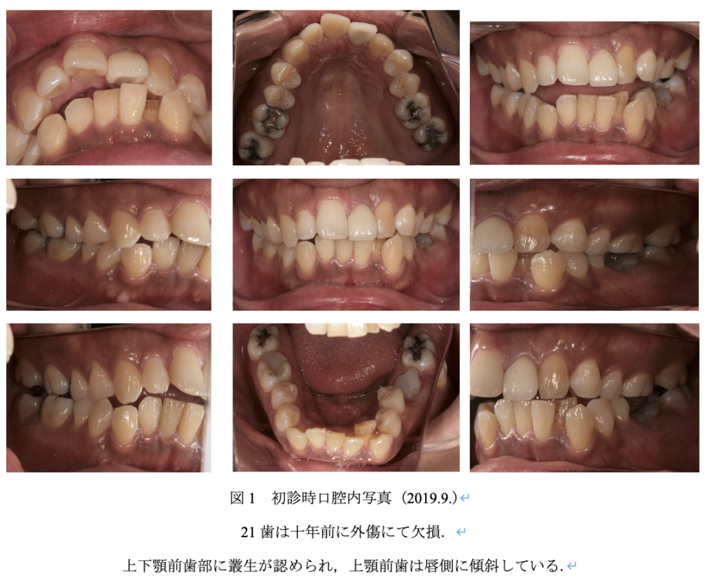 初診時