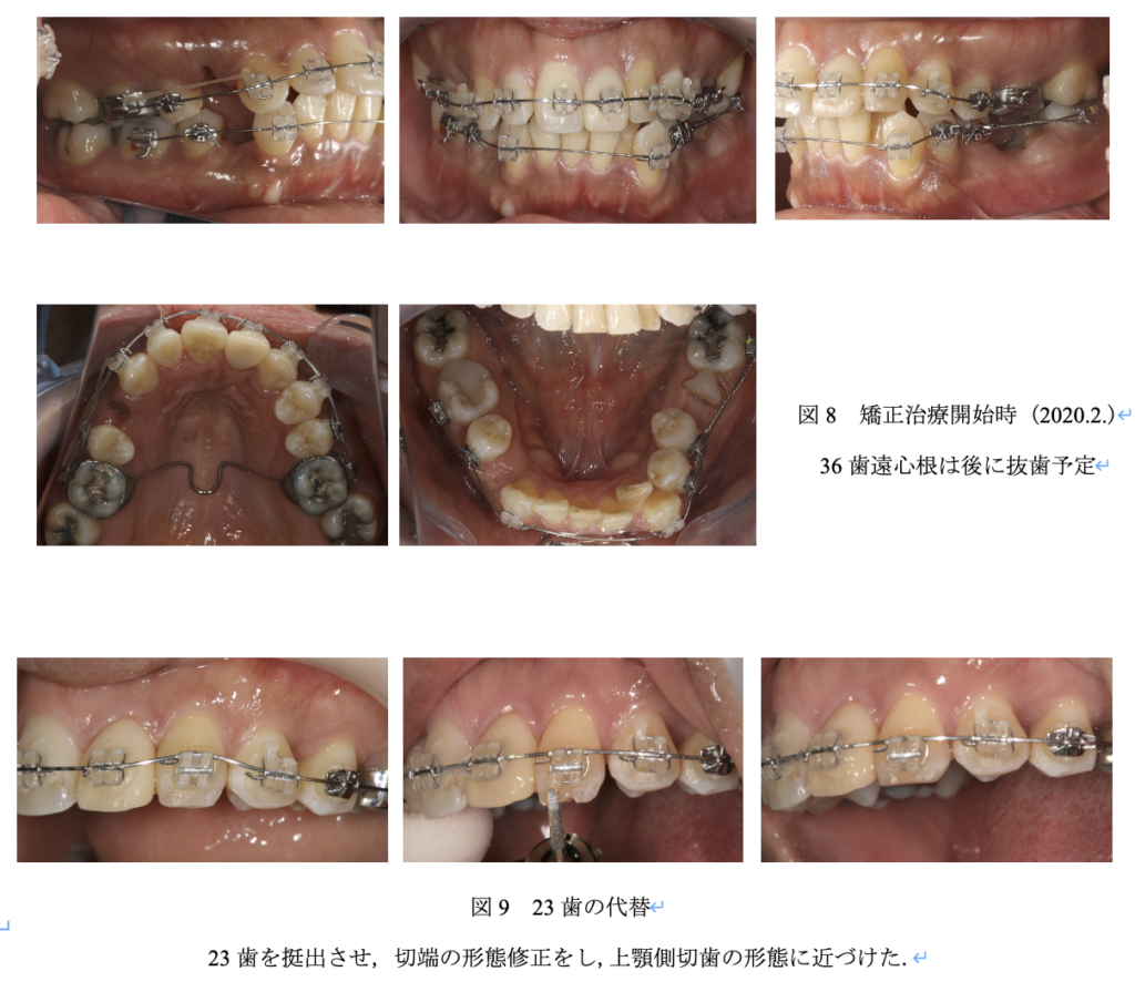 治療時