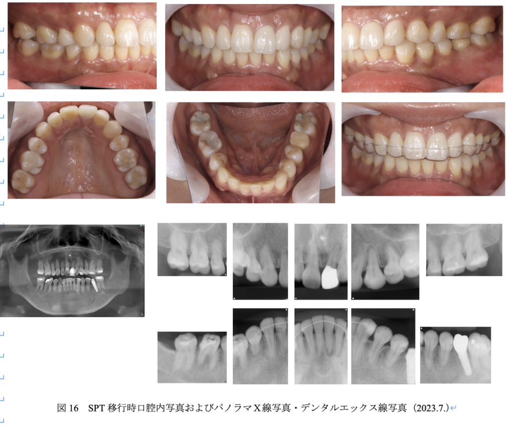 治療終了時