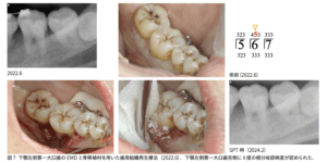 歯周病学会誌投稿 2025