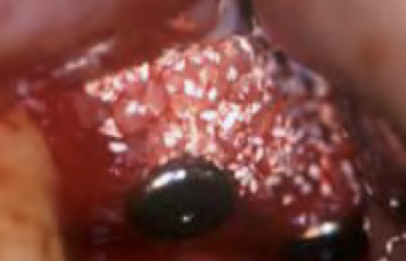 インプラントFAQ