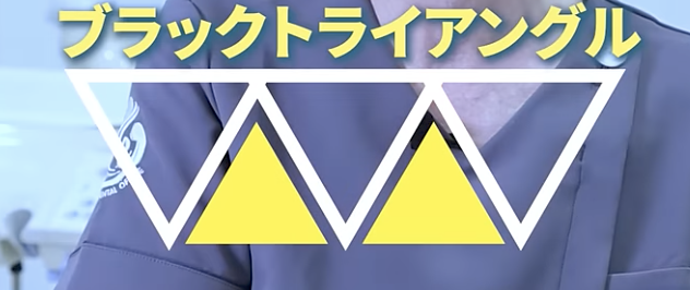 ブラックトライアングル