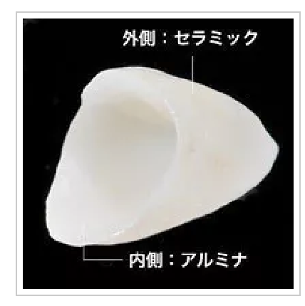 オールセラミッククラウン